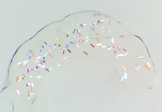 Crystals of AR3 observed under polarised light Crystals of AR3 observed under polarised light