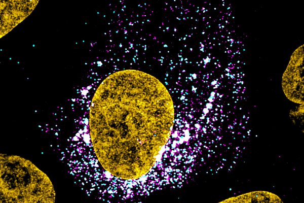 Image of a SARS-CoV-2 infected cell