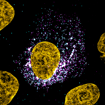 Image of a SARS-CoV-2 infected cell Image of a SARS-CoV-2 infected cell